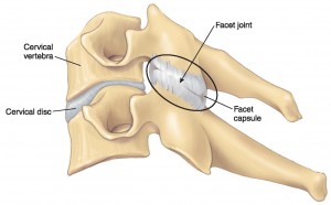 cervical-facet-joint-disc